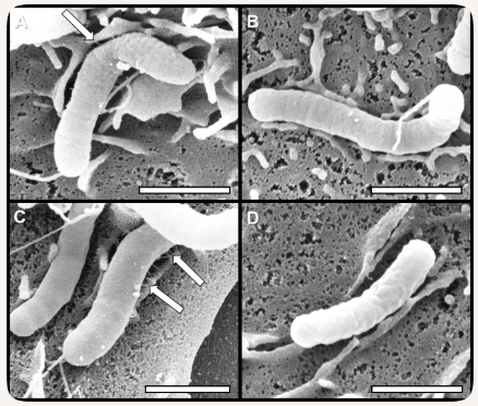 A infecção pelo Helicobacter pylori (H. pylori) induz inflamação persistente na mucosa gástrica com diferentes lesões orgânicas em humanos, tais como gastrite crônica, úlcera péptica e câncer gástrico.